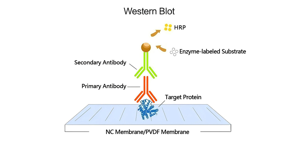 WESTERN BLOT