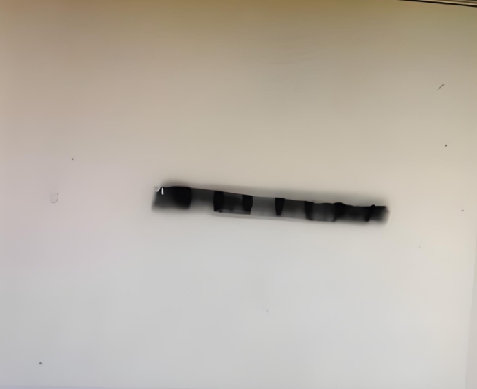 Reasons for nonspecific bands in WB experiments