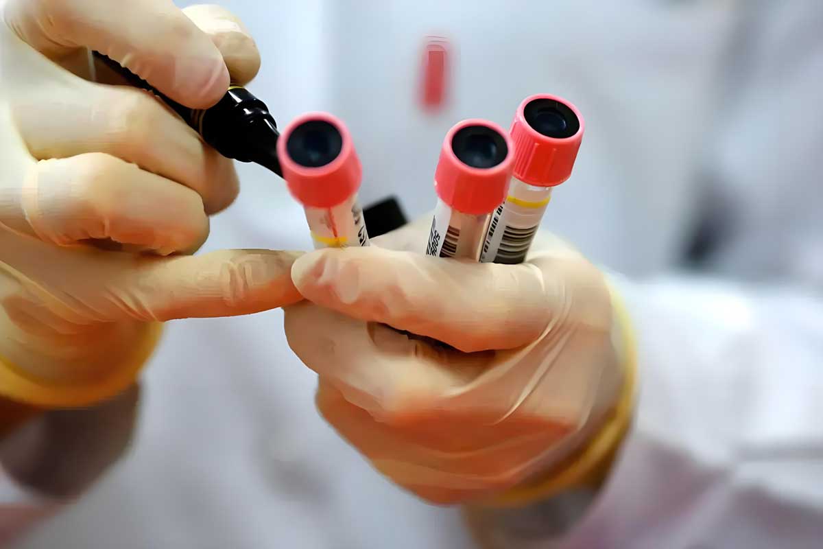 red blood cell antibodies