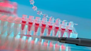 RNA transcription experiment
