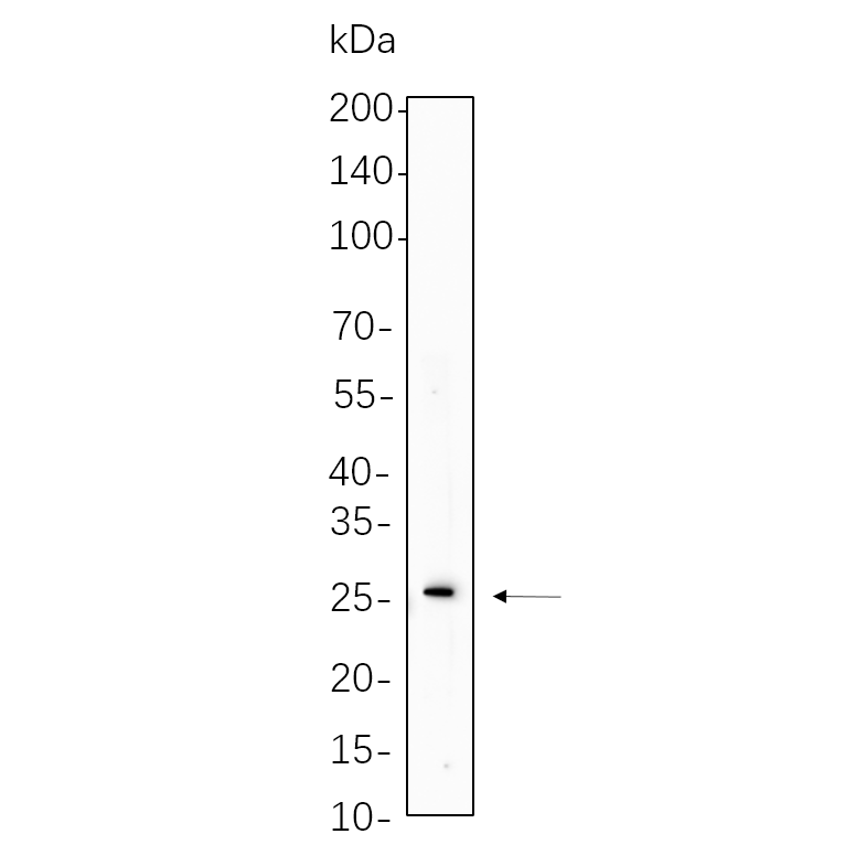 WR4004 RAW264.7 cell lysates were separated by 4-20% SDS-PAGE, and the membrane was blotted with primary antibody 1:1000. The HRP-conjugated Goat anti-Rabbit IgG(H + L) antibody was used to detect the antibody. RAW264.7 cell lysates were separated by 4-20% SDS-PAGE, and the membrane was blotted with primary antibody 1:1000. The HRP-conjugated Goat anti-Rabbit IgG(H + L) antibody was used to detect the antibody.