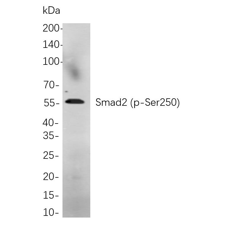 WR4011 Western blot analysis of lysates from A549 treated with TPA for 48 hours cells, using Smad2 (p-Ser250) Rabbit mAb. The HRP-conjugated Goat anti-Rabbit IgG antibody (RS0002,immunoway) was used to detect the antibody. Western blot analysis of lysates from A549 treated with TPA for 48 hours cells, using Smad2 (p-Ser250) Rabbit mAb. The HRP-conjugated Goat anti-Rabbit IgG antibody (RS0002,immunoway) was used to detect the antibody.