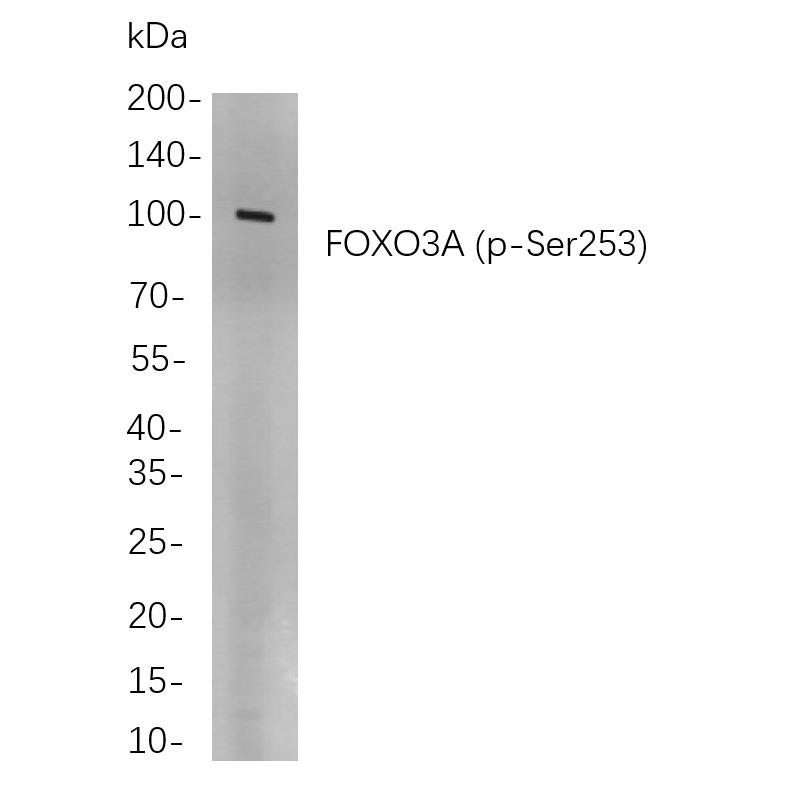 WR4013 Western blot analysis of lysates from HEK293 cells, using FOXO3A (p-Ser253) Rabbit mAb. The HRP-conjugated Goat anti-Rabbit IgG antibody (RS0002,immunoway) was used to detect the antibody. Western blot analysis of lysates from HEK293 cells, using FOXO3A (p-Ser253) Rabbit mAb. The HRP-conjugated Goat anti-Rabbit IgG antibody (RS0002,immunoway) was used to detect the antibody.