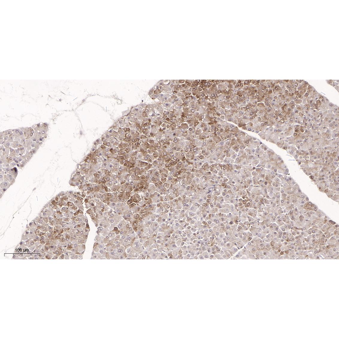 WR4013 Immunohistochemical analysis of paraffin-embedded mouse pancreas tissue. 1, primary Antibody was diluted at 1:200(4~C,overnight). 2, EDTA pH 9.0 was used for antibody retrieval(>98~C,20min). 3,Secondary antibody was diluted at 1:200(room tempeRature, 30min). Immunohistochemical analysis of paraffin-embedded mouse pancreas tissue. 1, primary Antibody was diluted at 1:200(4~C,overnight). 2, EDTA pH 9.0 was used for antibody retrieval(>98~C,20min). 3,Secondary antibody was diluted at 1:200(room tempeRature, 30min).