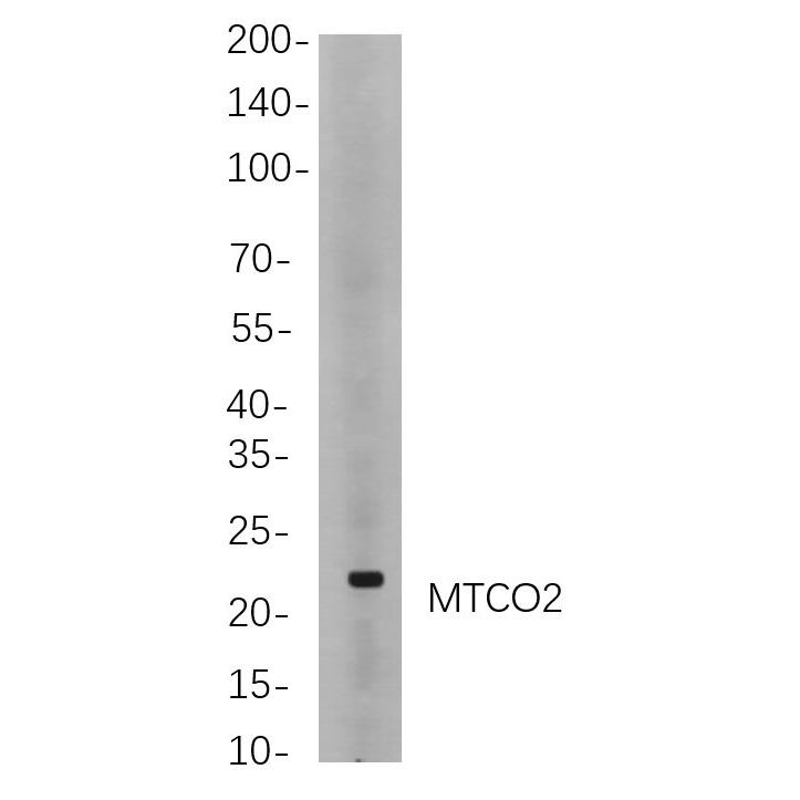 WR4017 Western blot analysis of lysates from Hela cells, using MTCO2 Rabbit mAb. The HRP-conjugated Goat anti-Rabbit IgG antibody (RS0002,immunoway) was used to detect the antibody. Western blot analysis of lysates from Hela cells, using MTCO2 Rabbit mAb. The HRP-conjugated Goat anti-Rabbit IgG antibody (RS0002,immunoway) was used to detect the antibody.