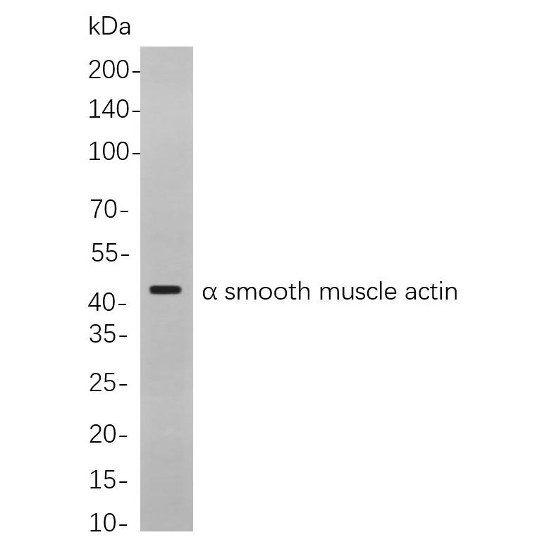 WR4021 Western blot analysis of lysates from K562 cells, using α smooth muscle actin Rabbit mAb. The HRP-conjugated Goat anti-Rabbit IgG antibody (RS0002,immunoway) was used to detect the antibody. Western blot analysis of lysates from K562 cells, using α smooth muscle actin Rabbit mAb. The HRP-conjugated Goat anti-Rabbit IgG antibody (RS0002,immunoway) was used to detect the antibody.