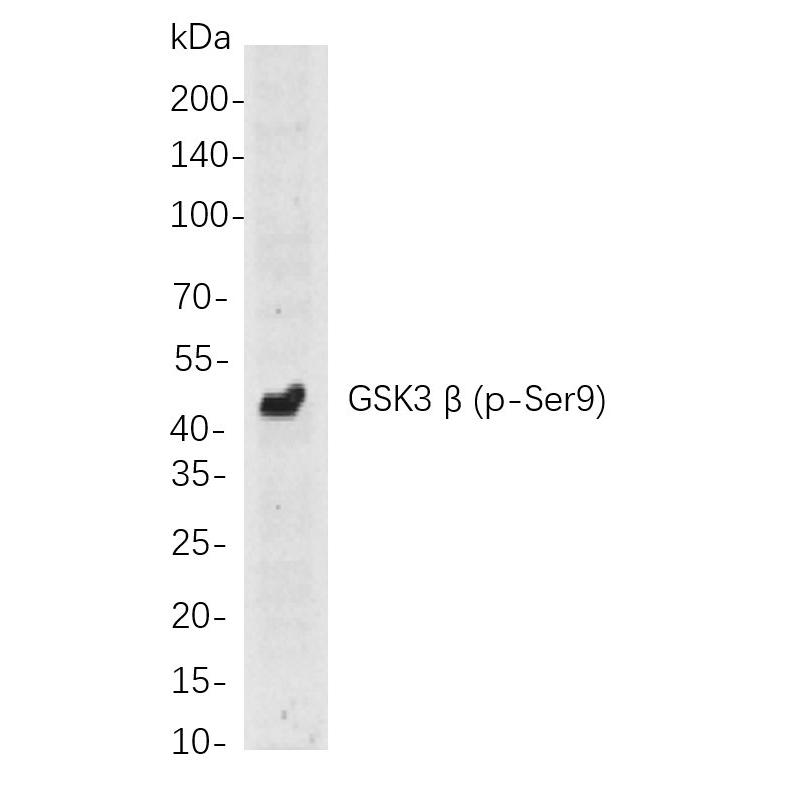 WR4022 Western blot analysis of lysates from Hela cells, using GSK3 β (p-Ser9) Rabbit mAb. The HRP-conjugated Goat anti-Rabbit IgG antibody (RS0002,immunoway) was used to detect the antibody. Western blot analysis of lysates from Hela cells, using GSK3 β (p-Ser9) Rabbit mAb. The HRP-conjugated Goat anti-Rabbit IgG antibody (RS0002,immunoway) was used to detect the antibody.