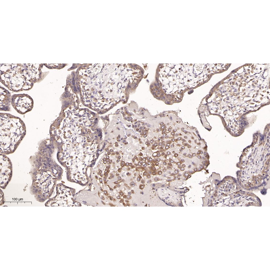 WR4026 Immunohistochemical analysis of paraffin-embedded Human placenta tissue. 1, primary Antibody was diluted at 1:200(4~C,overnight). 2, EDTA pH 9.0 was used for antibody retrieval(>98~C,20min). 3,Secondary antibody was diluted at 1:200(room tempeRature, 30min). Immunohistochemical analysis of paraffin-embedded Human placenta tissue. 1, primary Antibody was diluted at 1:200(4~C,overnight). 2, EDTA pH 9.0 was used for antibody retrieval(>98~C,20min). 3,Secondary antibody was diluted at 1:200(room tempeRature, 30min).