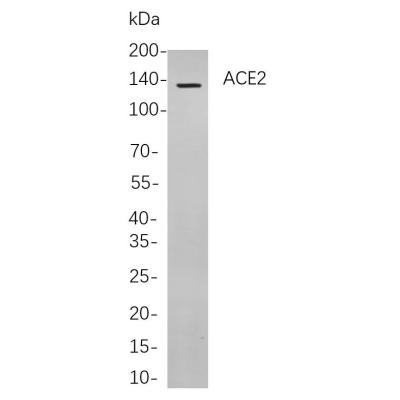 Western blot analysis of lysates from CACO-2 cells, using ACE2 Rabbit mAb. The HRP-conjugated Goat anti-Rabbit IgG antibody (WS0002) was used to detect the antibody.