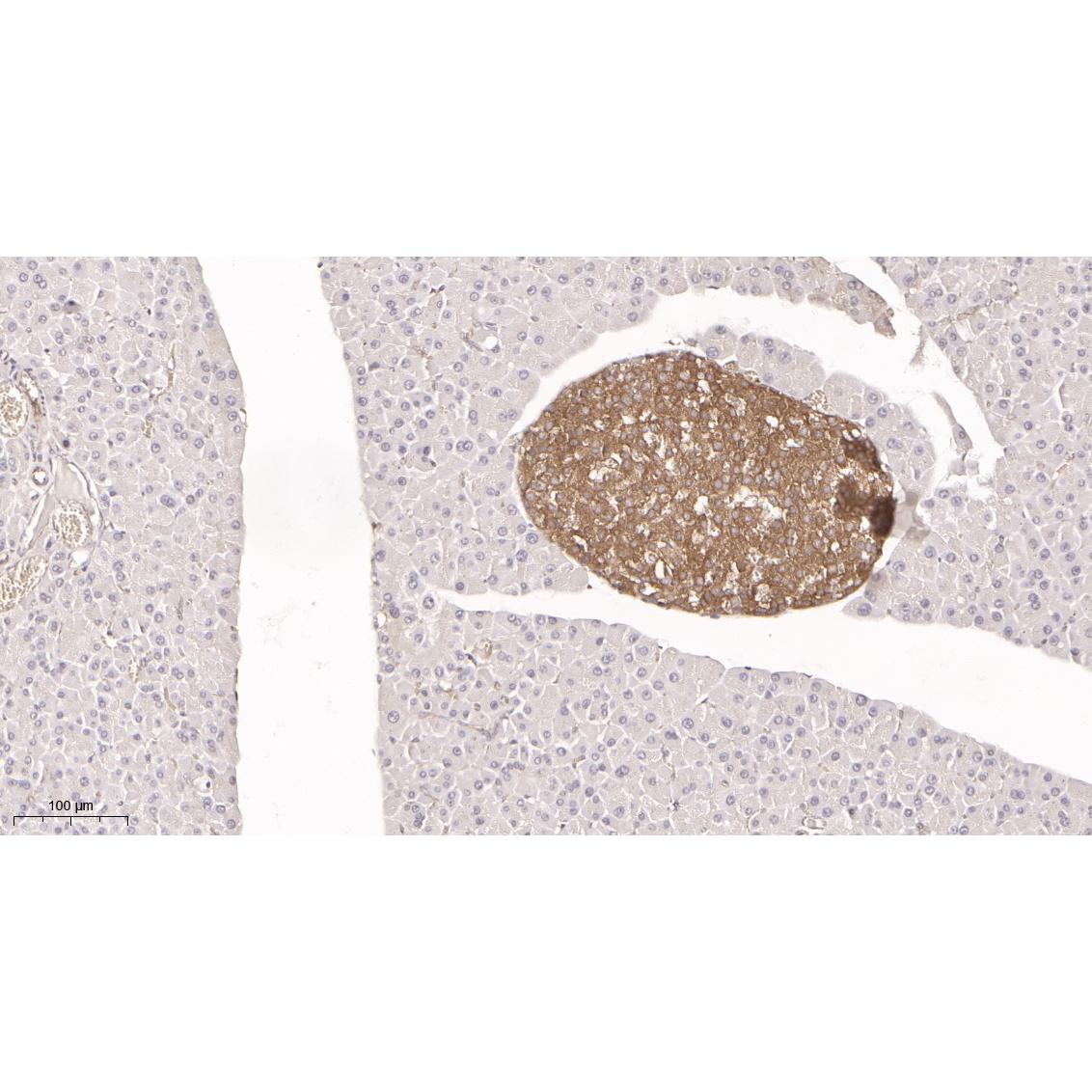 WR4030 Immunohistochemical analysis of paraffin-embedded mouse pancreas tissue. 1, primary Antibody was diluted at 1:200(4~C,overnight). 2, EDTA pH 9.0 was used for antibody retrieval(>98~C,20min). 3,Secondary antibody was diluted at 1:200(room tempeRature, 30min). Immunohistochemical analysis of paraffin-embedded mouse pancreas tissue. 1, primary Antibody was diluted at 1:200(4~C,overnight). 2, EDTA pH 9.0 was used for antibody retrieval(>98~C,20min). 3,Secondary antibody was diluted at 1:200(room tempeRature, 30min).