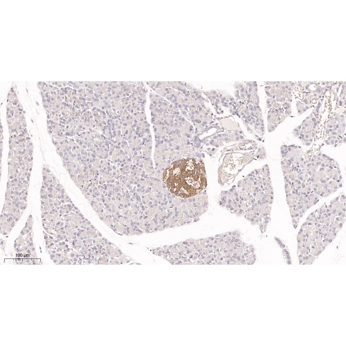 WR4030 Immunohistochemical analysis of paraffin-embedded rat pancreas tissue. 1, primary Antibody was diluted at 1:200(4~C,overnight). 2, EDTA pH 9.0 was used for antibody retrieval(>98~C,20min). 3,Secondary antibody was diluted at 1:200(room tempeRature, 30min). Immunohistochemical analysis of paraffin-embedded rat pancreas tissue. 1, primary Antibody was diluted at 1:200(4~C,overnight). 2, EDTA pH 9.0 was used for antibody retrieval(>98~C,20min). 3,Secondary antibody was diluted at 1:200(room tempeRature, 30min).