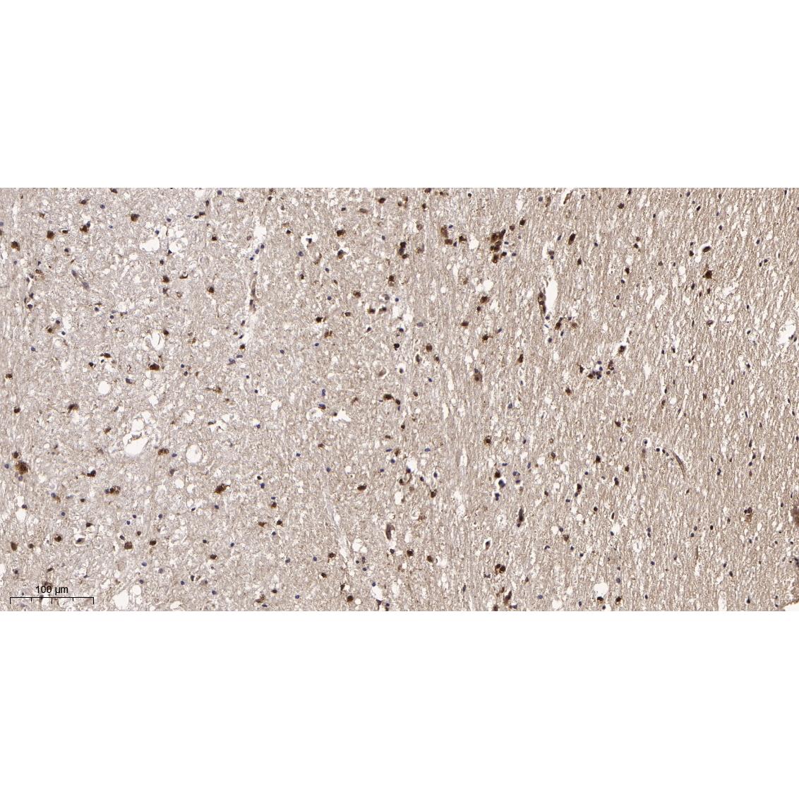 WR4030 Immunohistochemical analysis of paraffin-embedded human brain tissue. 1, primary Antibody was diluted at 1:200(4~C,overnight). 2, EDTA pH 9.0 was used for antibody retrieval(>98~C,20min). 3,Secondary antibody was diluted at 1:200(room tempeRature, 30min). Immunohistochemical analysis of paraffin-embedded human brain tissue. 1, primary Antibody was diluted at 1:200(4~C,overnight). 2, EDTA pH 9.0 was used for antibody retrieval(>98~C,20min). 3,Secondary antibody was diluted at 1:200(room tempeRature, 30min).