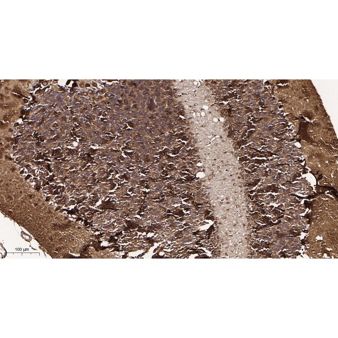 WR4030 Immunohistochemical analysis of paraffin-embedded mouse pancreas tissue. 1, primary Antibody was diluted at 1:200(4~C,overnight). 2, EDTA pH 9.0 was used for antibody retrieval(>98~C,20min). 3,Secondary antibody was diluted at 1:200(room tempeRature, 30min). Immunohistochemical analysis of paraffin-embedded mouse pancreas tissue. 1, primary Antibody was diluted at 1:200(4~C,overnight). 2, EDTA pH 9.0 was used for antibody retrieval(>98~C,20min). 3,Secondary antibody was diluted at 1:200(room tempeRature, 30min).