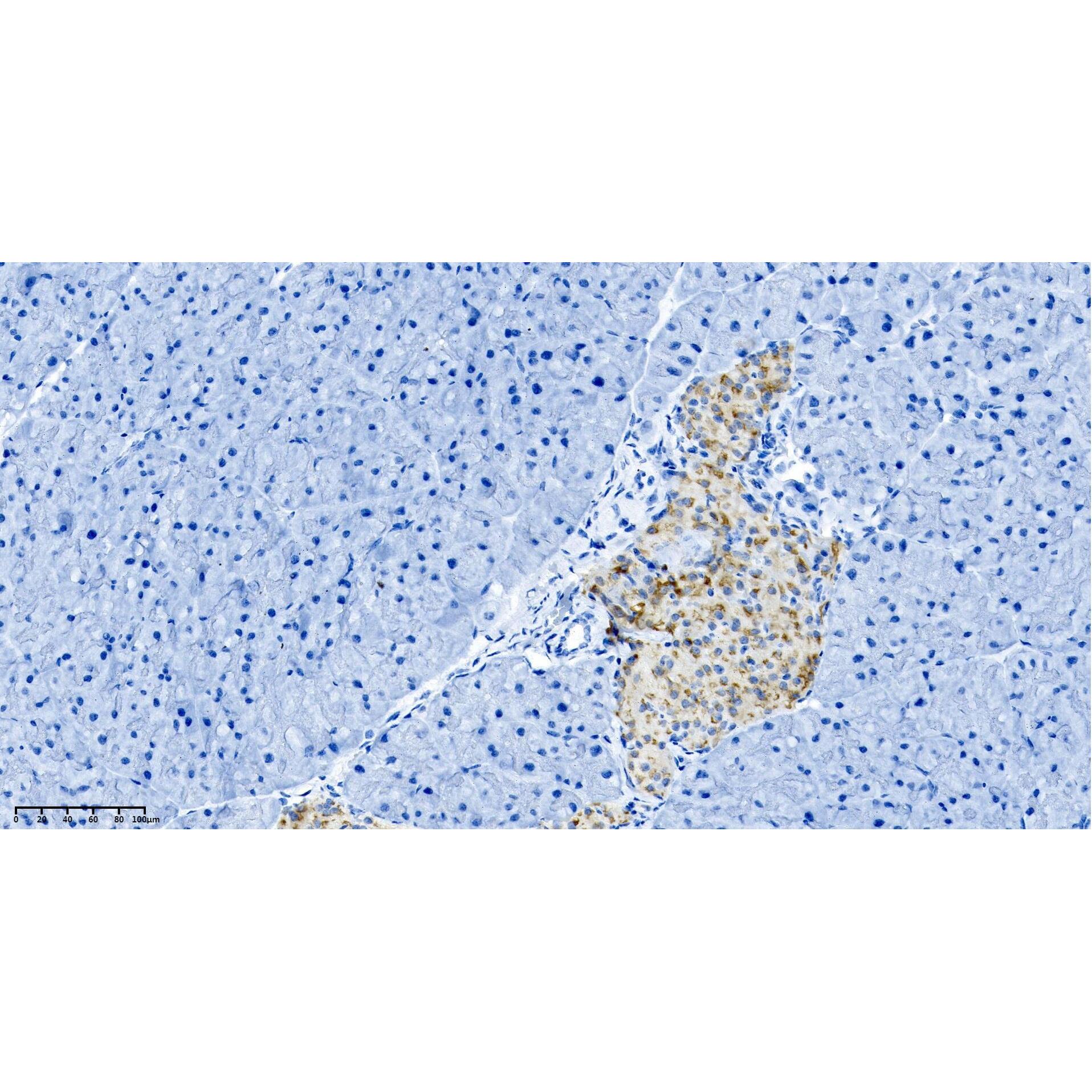 WR4034 Mouse pancreas WR4034 Mouse pancreas