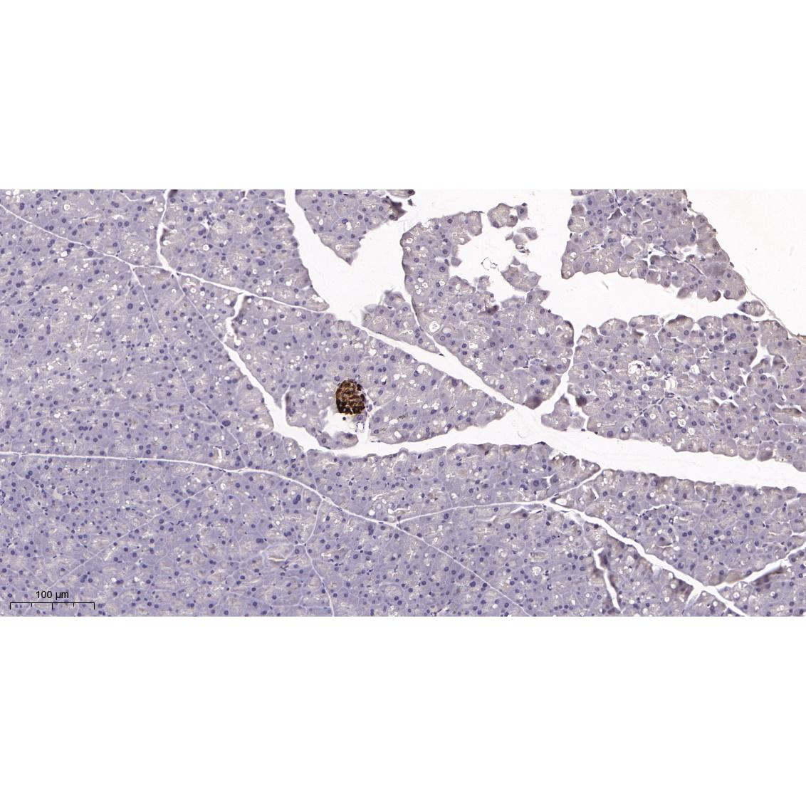 WR4034 Immunohistochemical analysis of paraffin-embedded Mouse pancreas tissue. 1, primary Antibody was diluted at 1:200(4~C,overnight). 2, EDTA pH 9.0 was used for antibody retrieval(>98~C,20min). 3,Secondary antibody was diluted at 1:200(room tempeRature, 30min). Immunohistochemical analysis of paraffin-embedded Mouse pancreas tissue. 1, primary Antibody was diluted at 1:200(4~C,overnight). 2, EDTA pH 9.0 was used for antibody retrieval(>98~C,20min). 3,Secondary antibody was diluted at 1:200(room tempeRature, 30min).