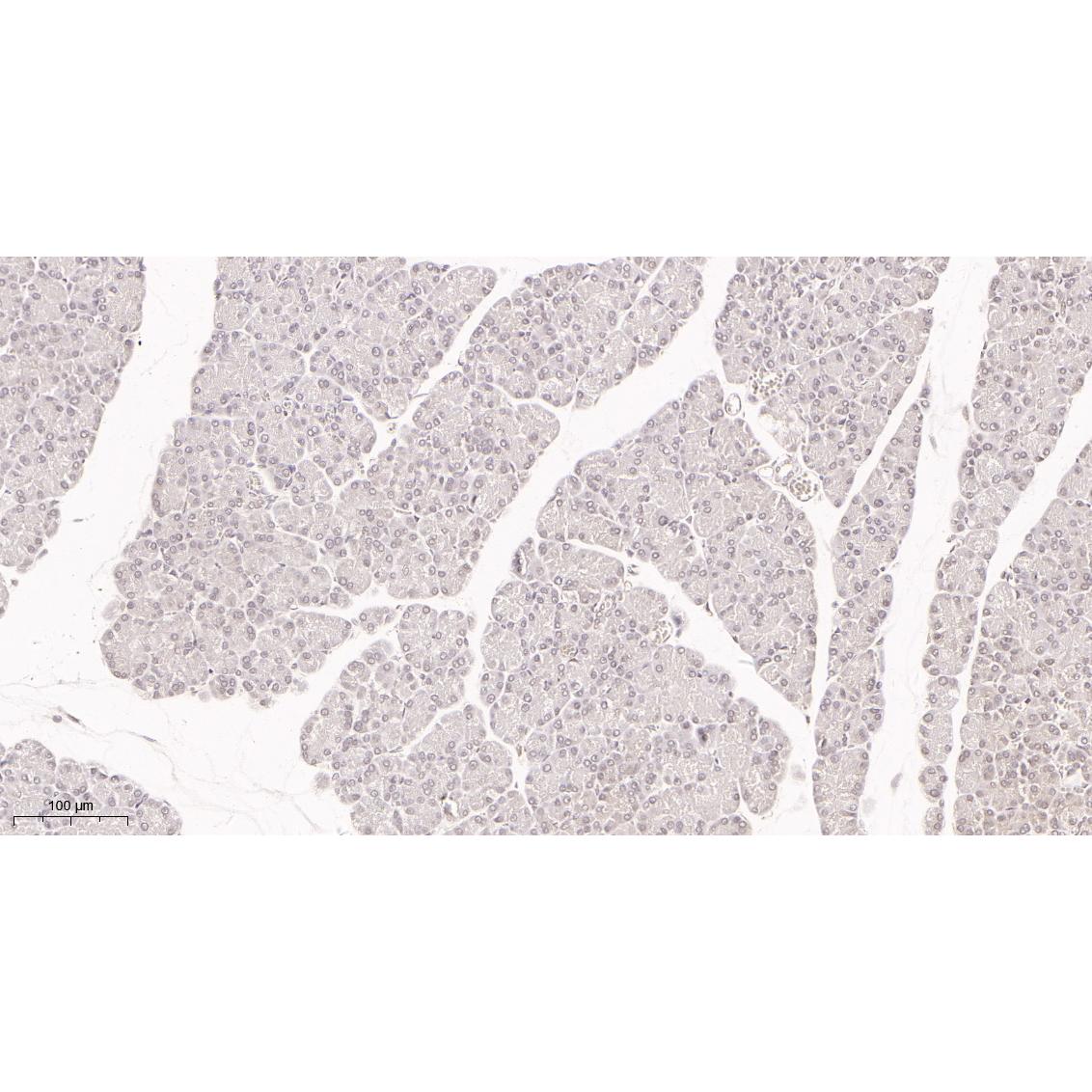 WR4034 Immunohistochemical analysis of paraffin-embedded Rat pancreas tissue. 1, primary Antibody was diluted at 1:200(4~C,overnight). 2, EDTA pH 9.0 was used for antibody retrieval(>98~C,20min). 3,Secondary antibody was diluted at 1:200(room tempeRature, 30min). Immunohistochemical analysis of paraffin-embedded Rat pancreas tissue. 1, primary Antibody was diluted at 1:200(4~C,overnight). 2, EDTA pH 9.0 was used for antibody retrieval(>98~C,20min). 3,Secondary antibody was diluted at 1:200(room tempeRature, 30min).