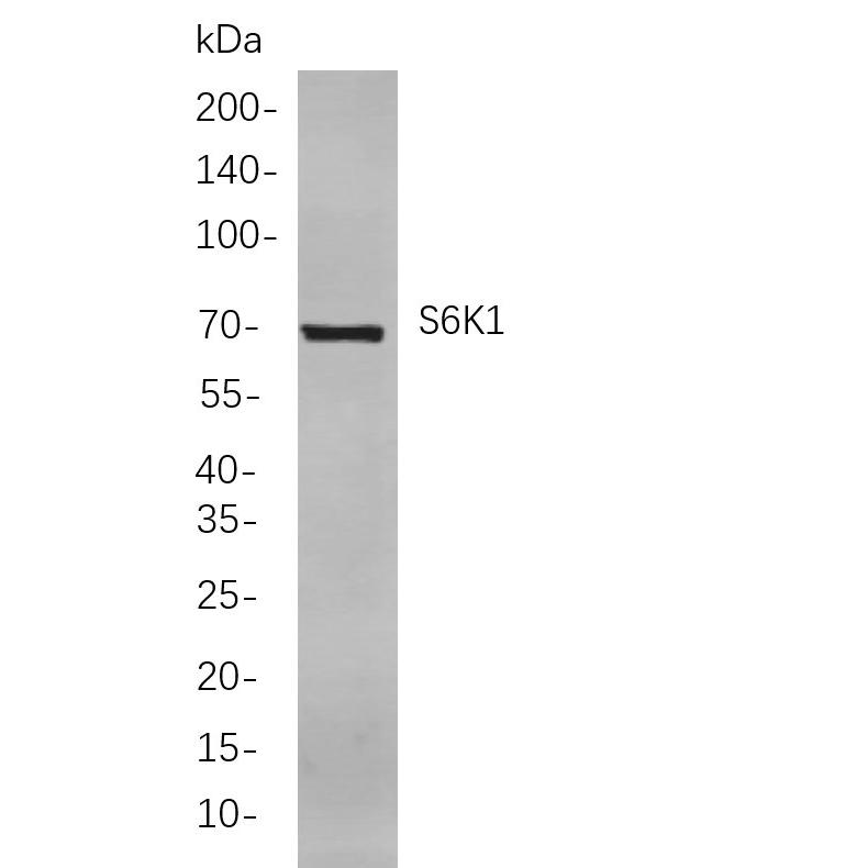 WR4035 Western blot analysis of lysates from HeLa cells, using S6K1 Rabbit mAb. The HRP-conjugated Goat anti-Rabbit IgG antibody (WS0002) was used to detect the antibody. Western blot analysis of lysates from HeLa cells, using S6K1 Rabbit mAb. The HRP-conjugated Goat anti-Rabbit IgG antibody (WS0002) was used to detect the antibody.