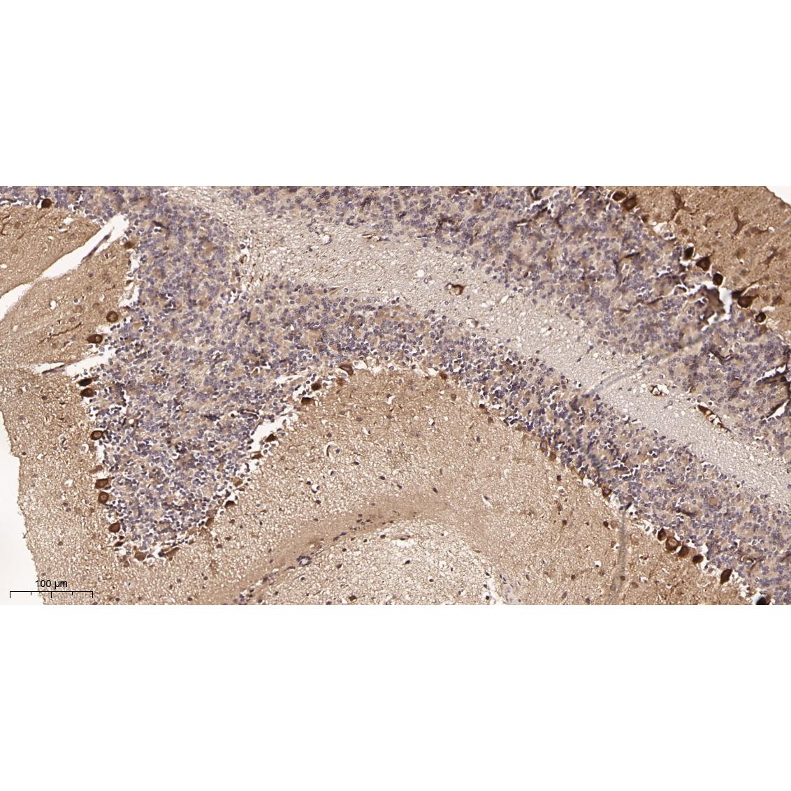 WR4035 Immunohistochemical analysis of paraffin-embedded Mouse brain tissue. 1, primary Antibody was diluted at 1:200(4~C,overnight). 2, EDTA pH 9.0 was used for antibody retrieval(>98~C,20min). 3,Secondary antibody was diluted at 1:200(room tempeRature, 30min). Immunohistochemical analysis of paraffin-embedded Mouse brain tissue. 1, primary Antibody was diluted at 1:200(4~C,overnight). 2, EDTA pH 9.0 was used for antibody retrieval(>98~C,20min). 3,Secondary antibody was diluted at 1:200(room tempeRature, 30min).