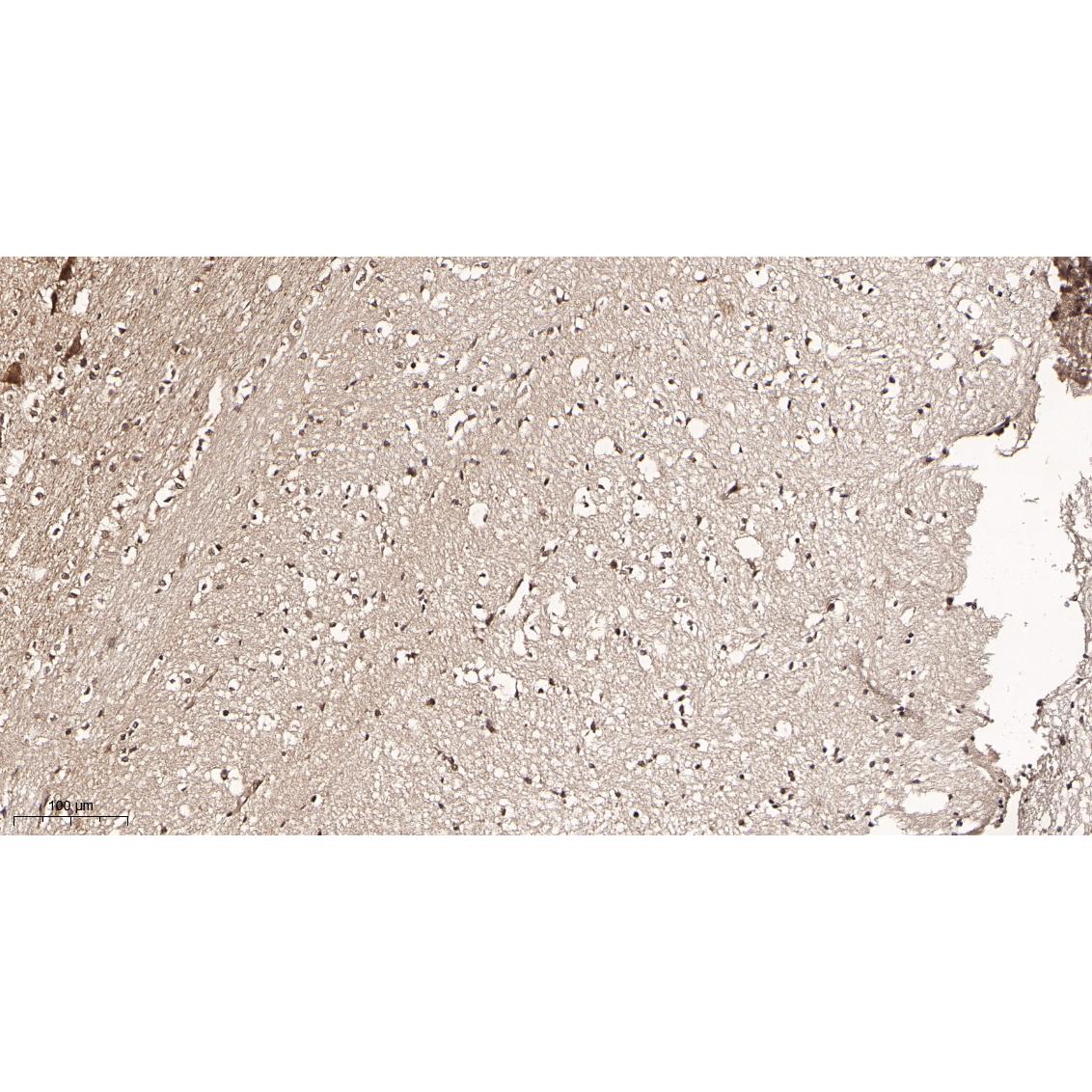 WR4035 Immunohistochemical analysis of paraffin-embedded Rat brain tissue. 1, primary Antibody was diluted at 1:200(4~C,overnight). 2, EDTA pH 9.0 was used for antibody retrieval(>98~C,20min). 3,Secondary antibody was diluted at 1:200(room tempeRature, 30min). Immunohistochemical analysis of paraffin-embedded Rat brain tissue. 1, primary Antibody was diluted at 1:200(4~C,overnight). 2, EDTA pH 9.0 was used for antibody retrieval(>98~C,20min). 3,Secondary antibody was diluted at 1:200(room tempeRature, 30min).