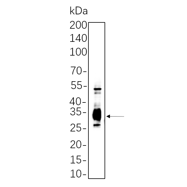 WR4038 Hela cell lysates were separated by 4-20% SDS-PAGE, and the membrane was blotted with primary antibody 1:1000. The HRP-conjugated Goat anti-Rabbit IgG(H + L) antibody was used to detect the antibody. Hela cell lysates were separated by 4-20% SDS-PAGE, and the membrane was blotted with primary antibody 1:1000. The HRP-conjugated Goat anti-Rabbit IgG(H + L) antibody was used to detect the antibody.