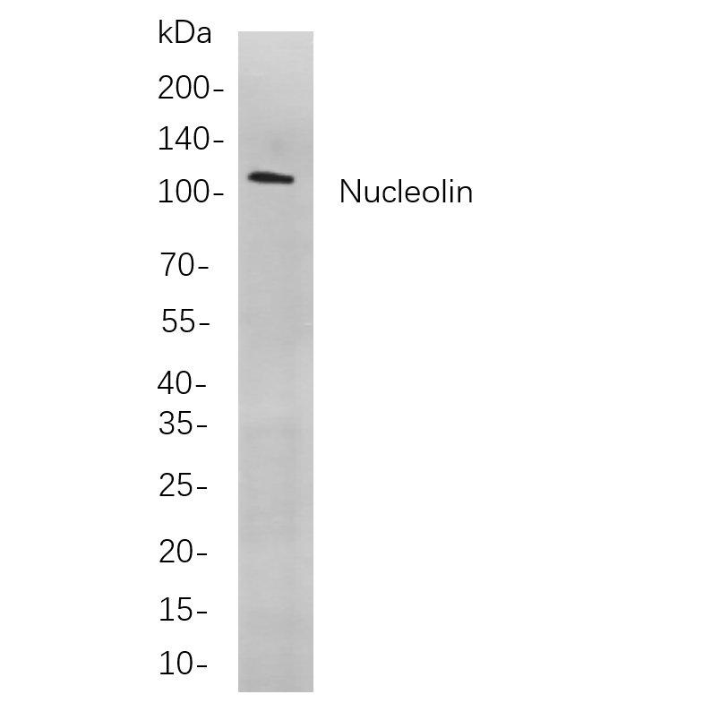 WR4039 Western blot analysis of lysates from A549 cells, using Nucleolin Rabbit mAb. The HRP-conjugated Goat anti-Rabbit IgG antibody (WS0002) was used to detect the antibody. Western blot analysis of lysates from A549 cells, using Nucleolin Rabbit mAb. The HRP-conjugated Goat anti-Rabbit IgG antibody (WS0002) was used to detect the antibody.