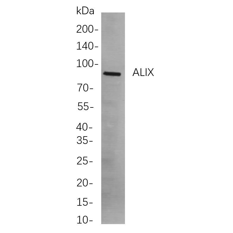 WR4043 Western blot analysis of lysates from Hela cells, using ALIX Rabbit mAb. The HRP-conjugated Goat anti-Rabbit IgG antibody (WS0002) was used to detect the antibody. Western blot analysis of lysates from Hela cells, using ALIX Rabbit mAb. The HRP-conjugated Goat anti-Rabbit IgG antibody (WS0002) was used to detect the antibody.
