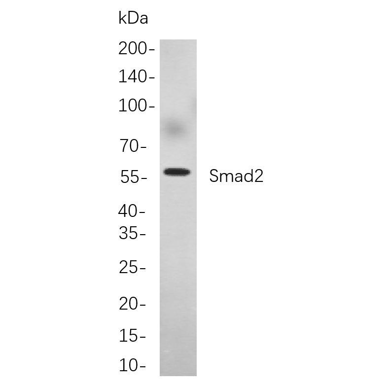 WR4044 Western blot analysis of lysates from A549 treated with TPA of 48 hours cells, using Smad2 Rabbit mAb. The HRP-conjugated Goat anti-Rabbit IgG antibody (WS0002) was used to detect the antibody. Western blot analysis of lysates from A549 treated with TPA of 48 hours cells, using Smad2 Rabbit mAb. The HRP-conjugated Goat anti-Rabbit IgG antibody (WS0002) was used to detect the antibody.