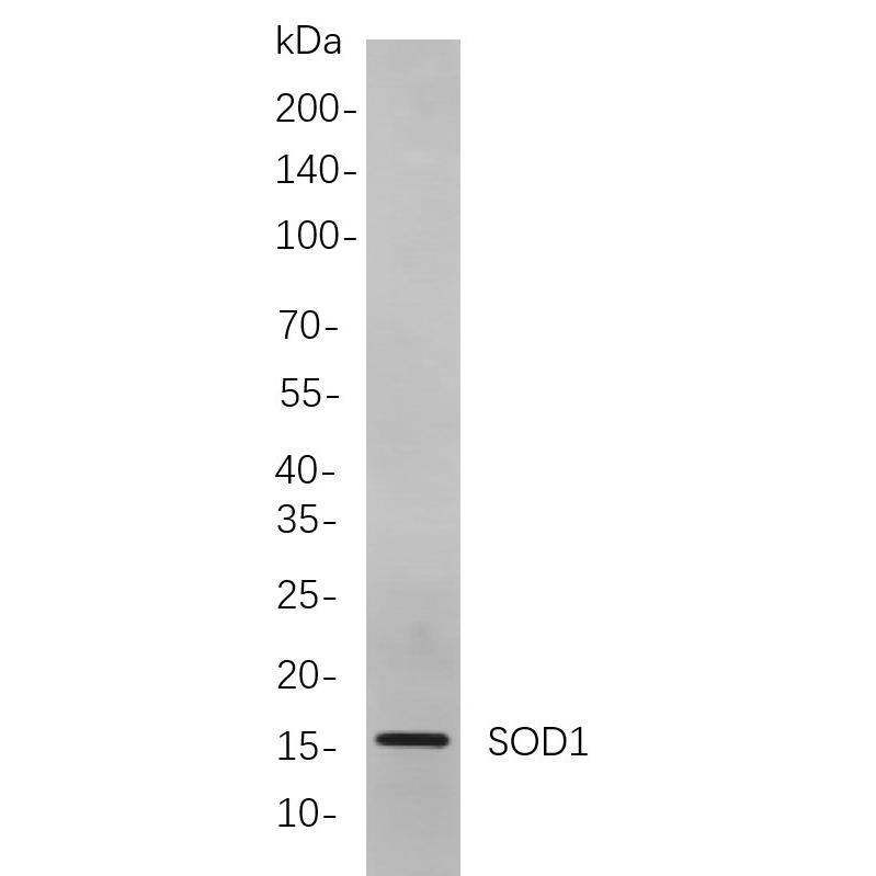 WR4045 Western blot analysis of lysates from A549 cells, using SOD1 Rabbit mAb. The HRP-conjugated Goat anti-Rabbit IgG antibody (WS0002) was used to detect the antibody. Western blot analysis of lysates from A549 cells, using SOD1 Rabbit mAb. The HRP-conjugated Goat anti-Rabbit IgG antibody (WS0002) was used to detect the antibody.