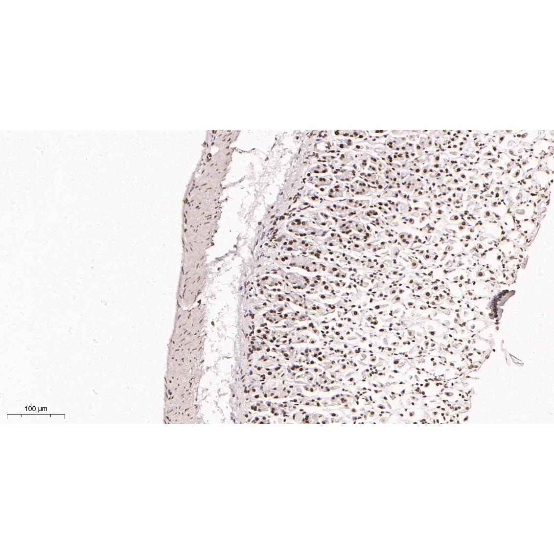 WR4055 Immunohistochemical analysis of paraffin-embedded mouse stomach tissue. 1, primary Antibody was diluted at 1:200(4~C,overnight). 2, EDTA pH 9.0 was used for antibody retrieval(>98~C,20min). 3,Secondary antibody was diluted at 1:200(room tempeRature, 30min). Immunohistochemical analysis of paraffin-embedded mouse stomach tissue. 1, primary Antibody was diluted at 1:200(4~C,overnight). 2, EDTA pH 9.0 was used for antibody retrieval(>98~C,20min). 3,Secondary antibody was diluted at 1:200(room tempeRature, 30min).