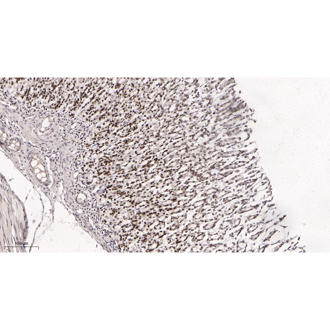 WR4055 Immunohistochemical analysis of paraffin-embedded rat stomach tissue. 1, primary Antibody was diluted at 1:200(4~C,overnight). 2, EDTA pH 9.0 was used for antibody retrieval(>98~C,20min). 3,Secondary antibody was diluted at 1:200(room tempeRature, 30min). Immunohistochemical analysis of paraffin-embedded rat stomach tissue. 1, primary Antibody was diluted at 1:200(4~C,overnight). 2, EDTA pH 9.0 was used for antibody retrieval(>98~C,20min). 3,Secondary antibody was diluted at 1:200(room tempeRature, 30min).