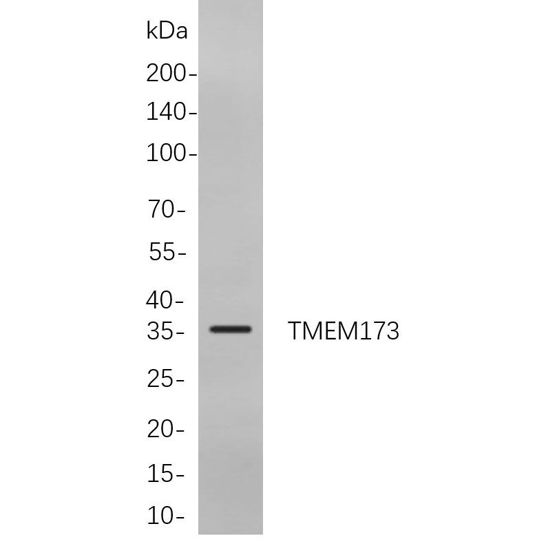 WR4056 Western blot analysis of lysates from Jurkat cells, using TMEM173 Rabbit mAb. The HRP-conjugated Goat anti-Rabbit IgG antibody (WS0002) was used to detect the antibody. Western blot analysis of lysates from Jurkat cells, using TMEM173 Rabbit mAb. The HRP-conjugated Goat anti-Rabbit IgG antibody (WS0002) was used to detect the antibody.
