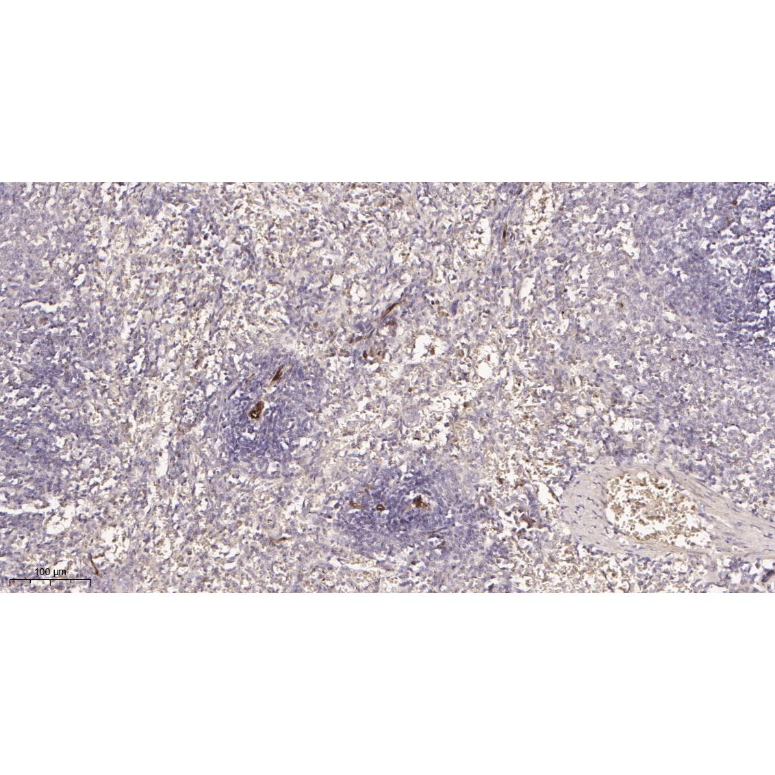 WR4056 Immunohistochemical analysis of paraffin-embedded rat spleen tissue. 1, primary Antibody was diluted at 1:200(4~C,overnight). 2, EDTA pH 9.0 was used for antibody retrieval(>98~C,20min). 3,Secondary antibody was diluted at 1:200(room tempeRature, 30min). Immunohistochemical analysis of paraffin-embedded rat spleen tissue. 1, primary Antibody was diluted at 1:200(4~C,overnight). 2, EDTA pH 9.0 was used for antibody retrieval(>98~C,20min). 3,Secondary antibody was diluted at 1:200(room tempeRature, 30min).
