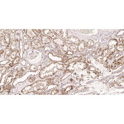 Immunohistochemical analysis of paraffin-embedded Human kidney tissue. 1, primary Antibody was diluted at 1:200(4～C,overnight). 2, EDTA pH 9.0 was used for antibody retrieval(>98～C,20min). 3,Secondary antibody was diluted at 1:200(room tempeRature, 30min).