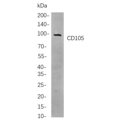 cells, using CD105 Rabbit mAb. The HRP-conjugated Goat anti-Rabbit IgG antibody (WS0002) was used to detect the antibody.