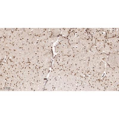 Immunohistochemical analysis of paraffin-embedded Mouse brain tissue. 1, primary Antibody was diluted at 1:200(4～C,overnight). 2, EDTA pH 9.0 was used for antibody retrieval(>98～C,20min). 3,Secondary antibody was diluted at 1:200(room tempeRature, 30min).