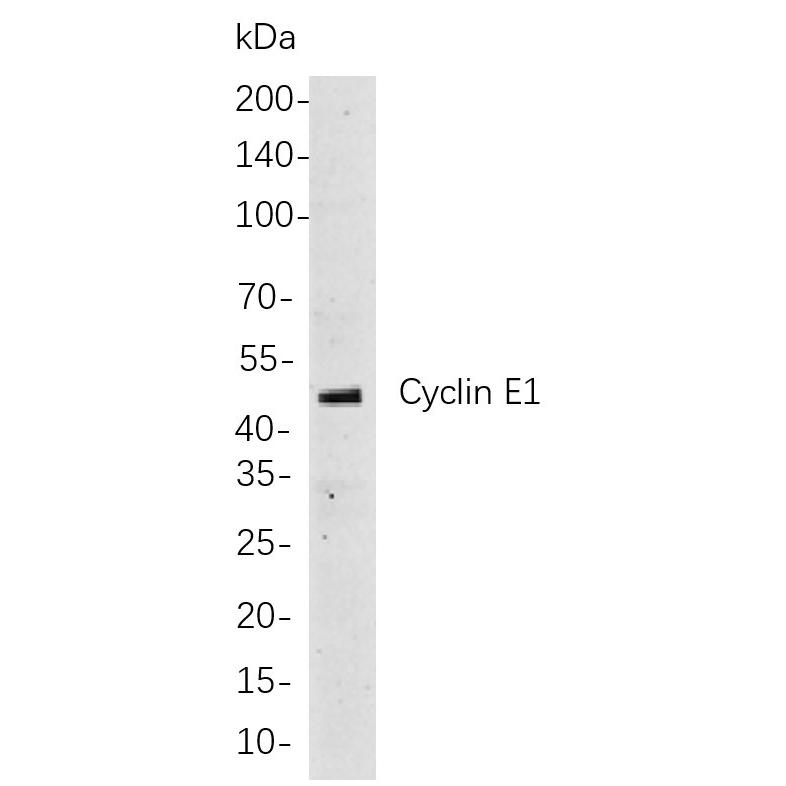 WR4078 Western blot analysis of lysates from Hela cells, using Cyclin E1 Rabbit mAb. The HRP-conjugated Goat anti-Rabbit IgG antibody (WS0002) was used to detect the antibody. Western blot analysis of lysates from Hela cells, using Cyclin E1 Rabbit mAb. The HRP-conjugated Goat anti-Rabbit IgG antibody (WS0002) was used to detect the antibody.