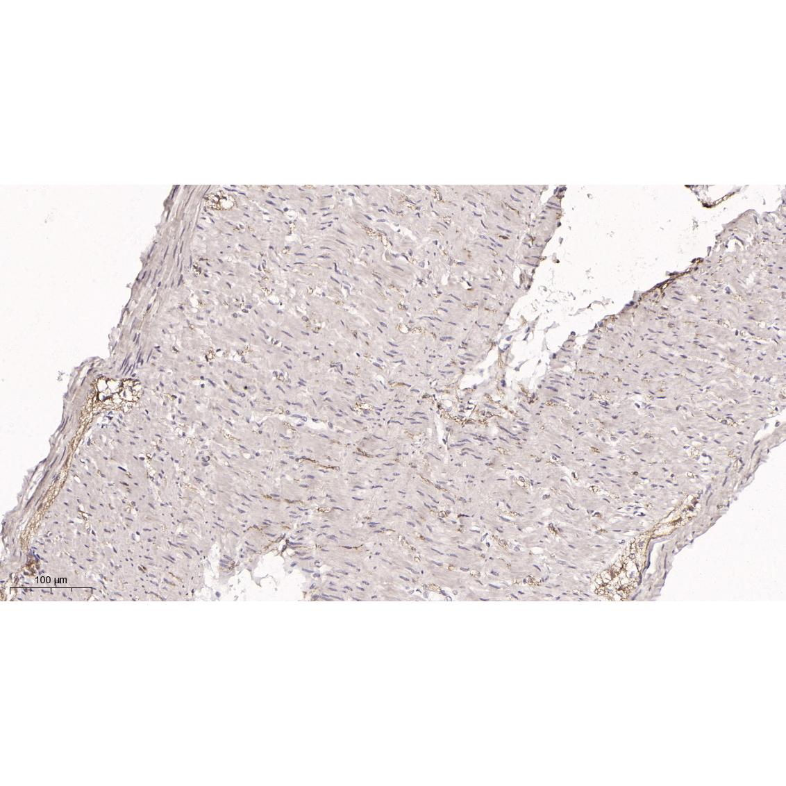 WR4078 Immunohistochemical analysis of paraffin-embedded rat colon tissue. 1, primary Antibody was diluted at 1:200(4~C,overnight). 2, EDTA pH 9.0 was used for antibody retrieval(>98~C,20min). 3,Secondary antibody was diluted at 1:200(room tempeRature, 30min). Immunohistochemical analysis of paraffin-embedded rat colon tissue. 1, primary Antibody was diluted at 1:200(4~C,overnight). 2, EDTA pH 9.0 was used for antibody retrieval(>98~C,20min). 3,Secondary antibody was diluted at 1:200(room tempeRature, 30min).