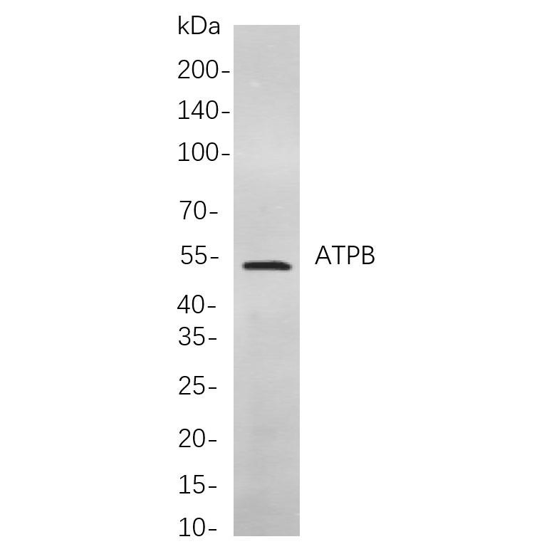 WR4083 Western blot analysis of lysates from Rat spleen cells, using ATPB Rabbit mAb. The HRP-conjugated Goat anti-Rabbit IgG antibody (WS0002) was used to detect the antibody. Western blot analysis of lysates from Rat spleen cells, using ATPB Rabbit mAb. The HRP-conjugated Goat anti-Rabbit IgG antibody (WS0002) was used to detect the antibody.