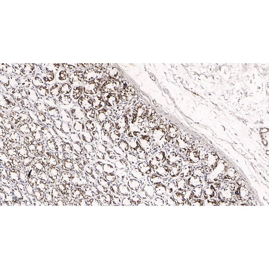 WR4084 Immunohistochemical analysis of paraffin-embedded rat colon tissue. 1, primary Antibody was diluted at 1:200(4~C,overnight). 2, EDTA pH 9.0 was used for antibody retrieval(>98~C,20min). 3,Secondary antibody was diluted at 1:200(room tempeRature, 30min). Immunohistochemical analysis of paraffin-embedded rat colon tissue. 1, primary Antibody was diluted at 1:200(4~C,overnight). 2, EDTA pH 9.0 was used for antibody retrieval(>98~C,20min). 3,Secondary antibody was diluted at 1:200(room tempeRature, 30min).
