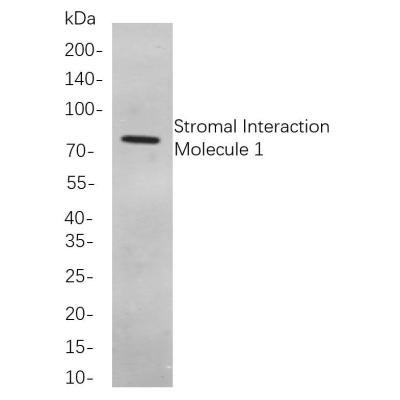 Immunohistochemical analysis of paraffin-embedded Human breast tissue. 1, primary Antibody was diluted at 1:200(4～C,overnight). 2, EDTA pH 9.0 was used for antibody retrieval(>98～C,20min). 3,Secondary antibody was diluted at 1:200(room tempeRature, 30min).