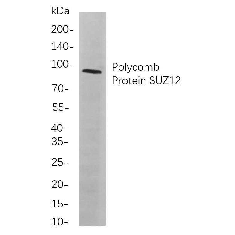 WR4107 Western blot analysis of lysates from A549 cells, using Polycomb Protein SUZ12 Rabbit mAb. The HRP-conjugated Goat anti-Rabbit IgG antibody (WS0002) was used to detect the antibody. Western blot analysis of lysates from A549 cells, using Polycomb Protein SUZ12 Rabbit mAb. The HRP-conjugated Goat anti-Rabbit IgG antibody (WS0002) was used to detect the antibody.