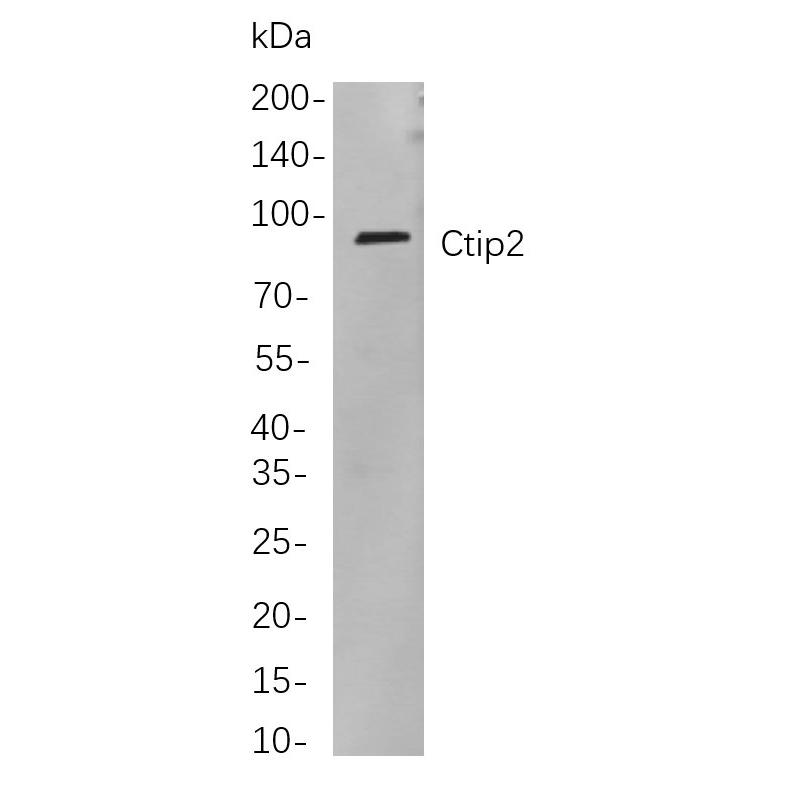 WR4110 Western blot analysis of lysates from Jurkat cells, using Ctip2 Rabbit mAb. The HRP-conjugated Goat anti-Rabbit IgG antibody (WS0002) was used to detect the antibody. Western blot analysis of lysates from Jurkat cells, using Ctip2 Rabbit mAb. The HRP-conjugated Goat anti-Rabbit IgG antibody (WS0002) was used to detect the antibody.