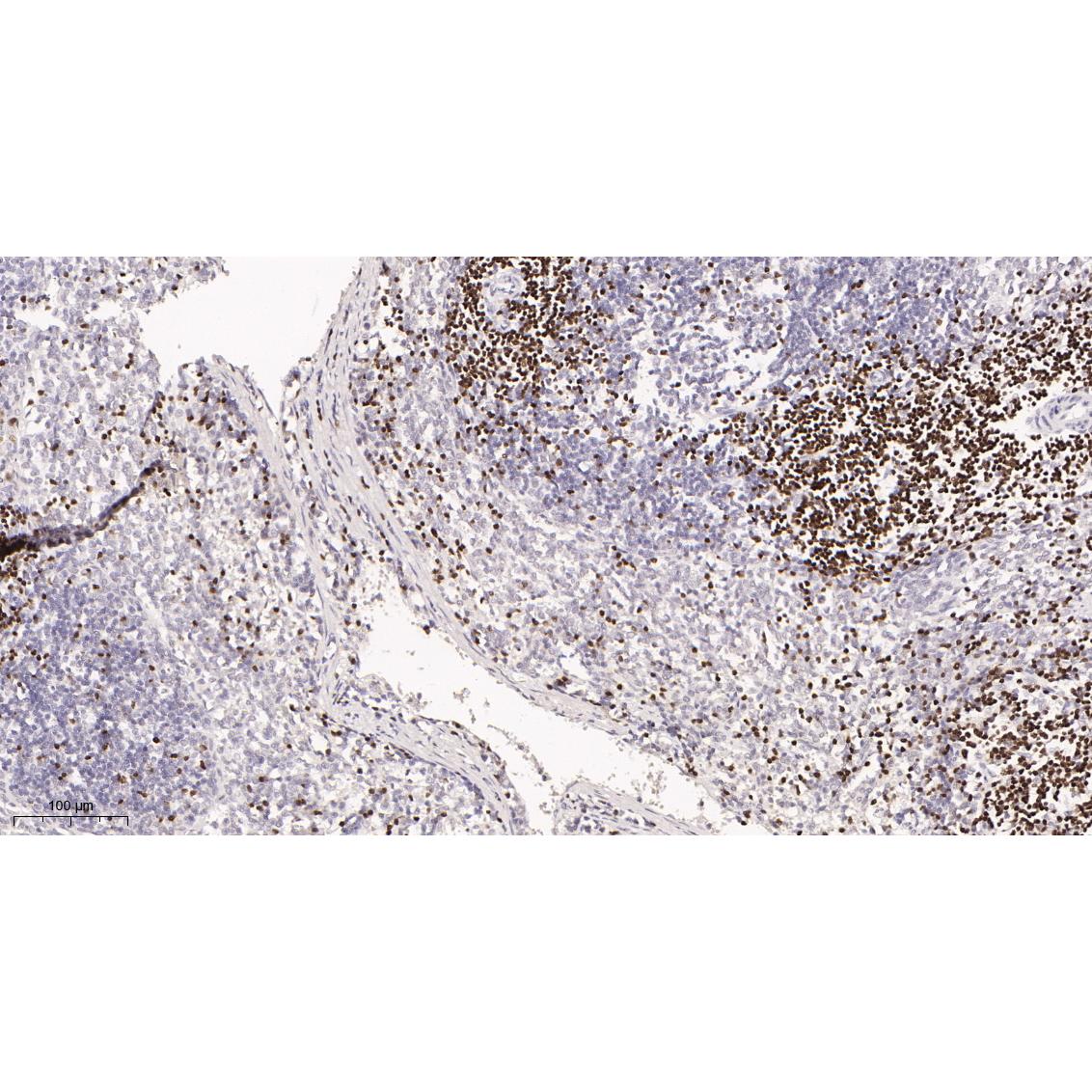 WR4110 Immunohistochemical analysis of paraffin-embedded rat spleen tissue. 1, primary Antibody was diluted at 1:200(4~C,overnight). 2, EDTA pH 9.0 was used for antibody retrieval(>98~C,20min). 3,Secondary antibody was diluted at 1:200(room tempeRature, 30min). Immunohistochemical analysis of paraffin-embedded rat spleen tissue. 1, primary Antibody was diluted at 1:200(4~C,overnight). 2, EDTA pH 9.0 was used for antibody retrieval(>98~C,20min). 3,Secondary antibody was diluted at 1:200(room tempeRature, 30min).