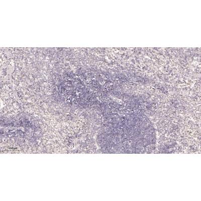 Immunohistochemical analysis of paraffin-embedded rat spleen tissue. 1, primary Antibody was diluted at 1:200(4～C,overnight). 2, EDTA pH 9.0 was used for antibody retrieval(>98～C,20min). 3,Secondary antibody was diluted at 1:200(room tempeRature, 30min).