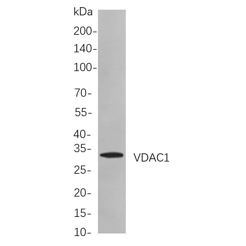 WR4115 Western blot analysis of lysates from Hela cells, using VDAC1 Rabbit mAb. The HRP-conjugated Goat anti-Rabbit IgG antibody (WS0002) was used to detect the antibody. Western blot analysis of lysates from Hela cells, using VDAC1 Rabbit mAb. The HRP-conjugated Goat anti-Rabbit IgG antibody (WS0002) was used to detect the antibody.