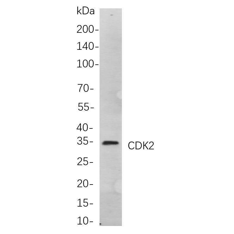 WR4125 Immunohistochemical analysis of paraffin-embedded Human tonsil tissue. 1, primary Antibody was diluted at 1:200(4~C,overnight). 2, EDTA pH 9.0 was used for antibody retrieval(>98~C,20min). 3,Secondary antibody was diluted at 1:200(room tempeRature, 30min). Immunohistochemical analysis of paraffin-embedded Human tonsil tissue. 1, primary Antibody was diluted at 1:200(4~C,overnight). 2, EDTA pH 9.0 was used for antibody retrieval(>98~C,20min). 3,Secondary antibody was diluted at 1:200(room tempeRature, 30min).
