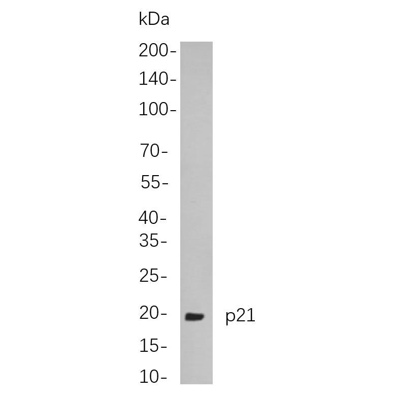WR4127 Western blot analysis of lysates from HCT-116 cells, using p21 Rabbit mAb. The HRP-conjugated Goat anti-Rabbit IgG antibody (WS0002) was used to detect the antibody. Western blot analysis of lysates from HCT-116 cells, using p21 Rabbit mAb. The HRP-conjugated Goat anti-Rabbit IgG antibody (WS0002) was used to detect the antibody.