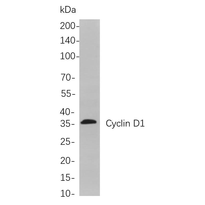 WR4128 Western blot analysis of lysates from Mosue spleen cells, using Cyclin D1 Rabbit mAb. The HRP-conjugated Goat anti-Rabbit IgG antibody (WS0002) was used to detect the antibody. Western blot analysis of lysates from Mosue spleen cells, using Cyclin D1 Rabbit mAb. The HRP-conjugated Goat anti-Rabbit IgG antibody (WS0002) was used to detect the antibody.