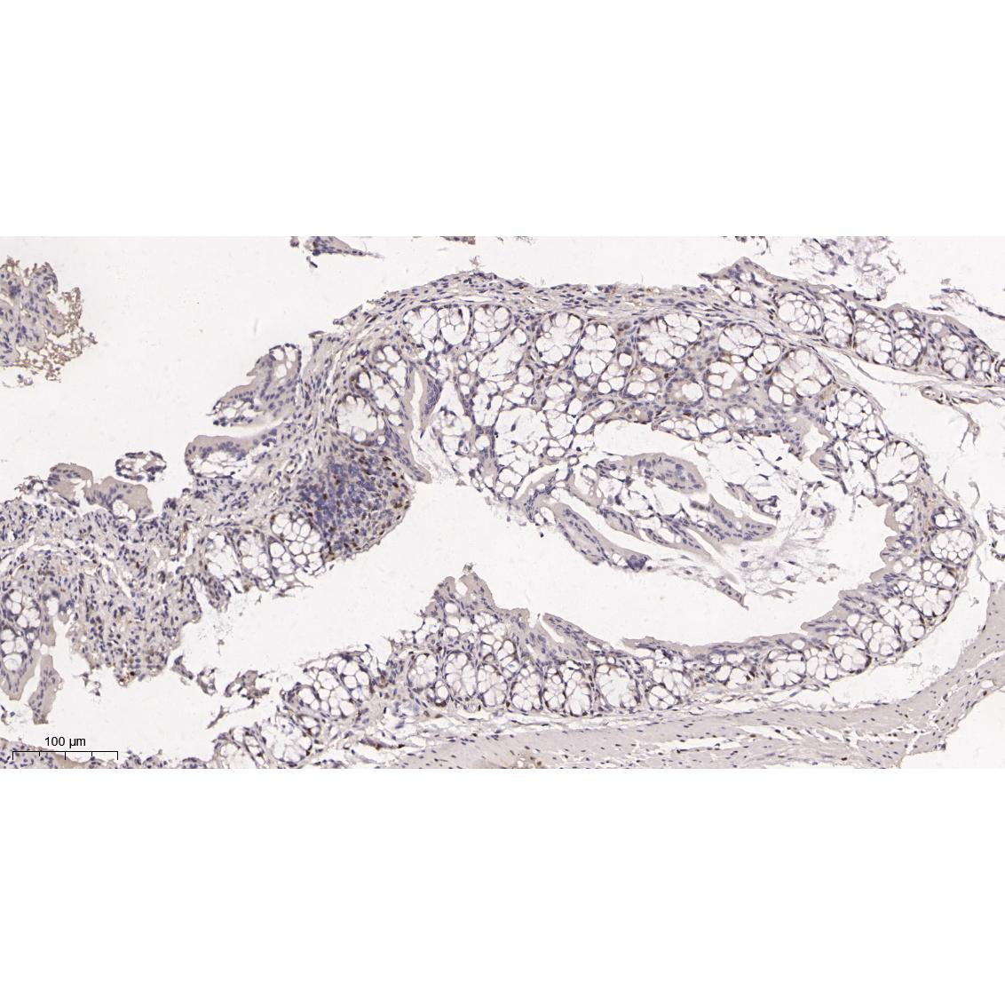 WR4128 Immunohistochemical analysis of paraffin-embedded Mouse colon tissue. 1, primary Antibody was diluted at 1:200(4~C,overnight). 2, EDTA pH 9.0 was used for antibody retrieval(>98~C,20min). 3,Secondary antibody was diluted at 1:200(room tempeRature, 30min). Immunohistochemical analysis of paraffin-embedded Mouse colon tissue. 1, primary Antibody was diluted at 1:200(4~C,overnight). 2, EDTA pH 9.0 was used for antibody retrieval(>98~C,20min). 3,Secondary antibody was diluted at 1:200(room tempeRature, 30min).
