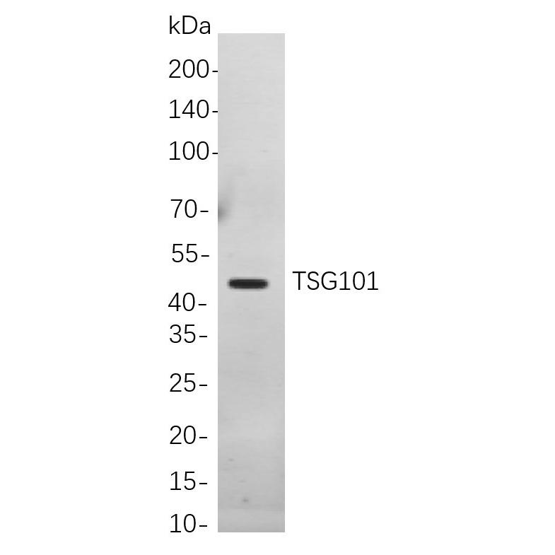 WR4129 Western blot analysis of lysates from Jurkat cells, using TSG101 Rabbit mAb. The HRP-conjugated Goat anti-Rabbit IgG antibody (WS0002) was used to detect the antibody. Western blot analysis of lysates from Jurkat cells, using TSG101 Rabbit mAb. The HRP-conjugated Goat anti-Rabbit IgG antibody (WS0002) was used to detect the antibody.